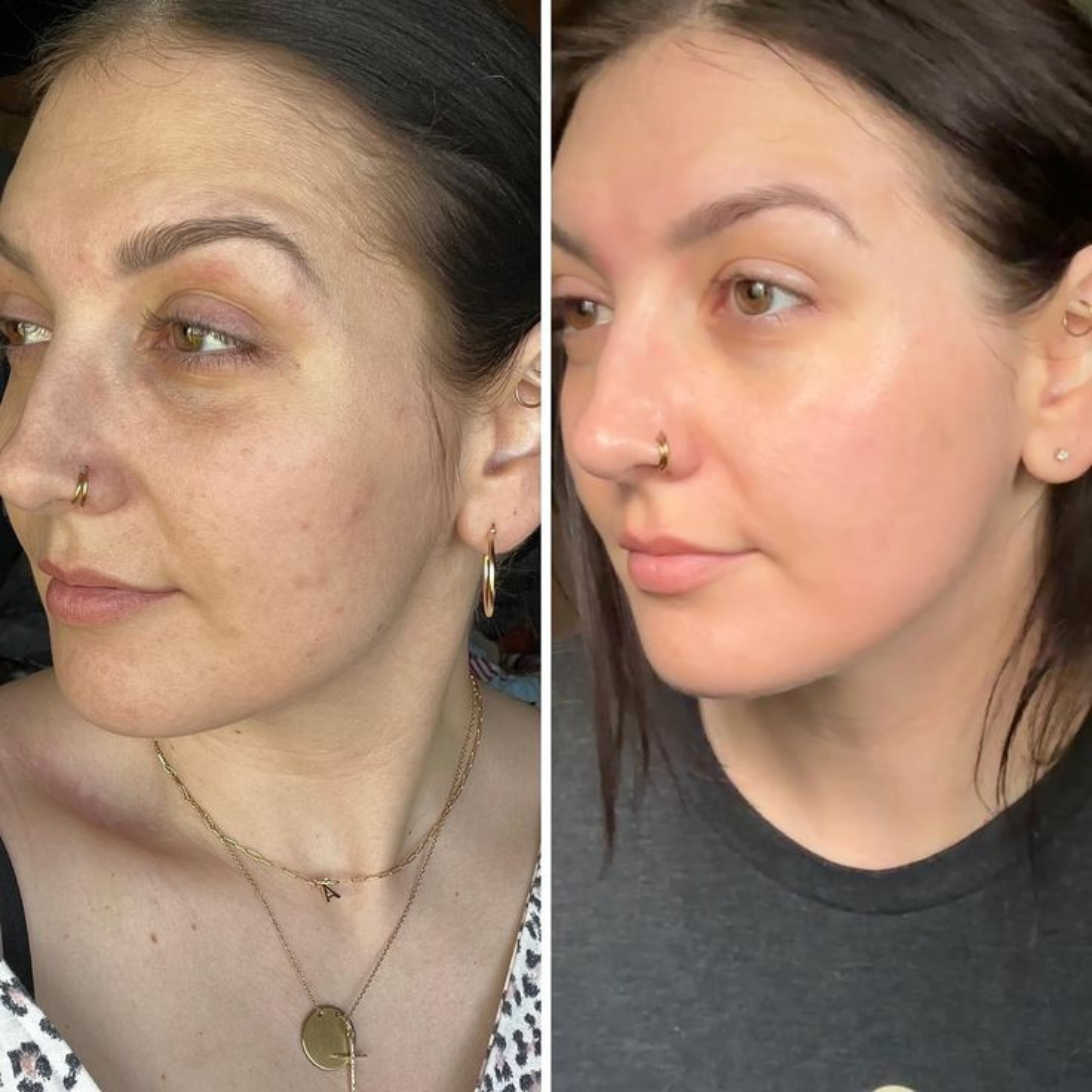 PDRN Pink Peptide Serum