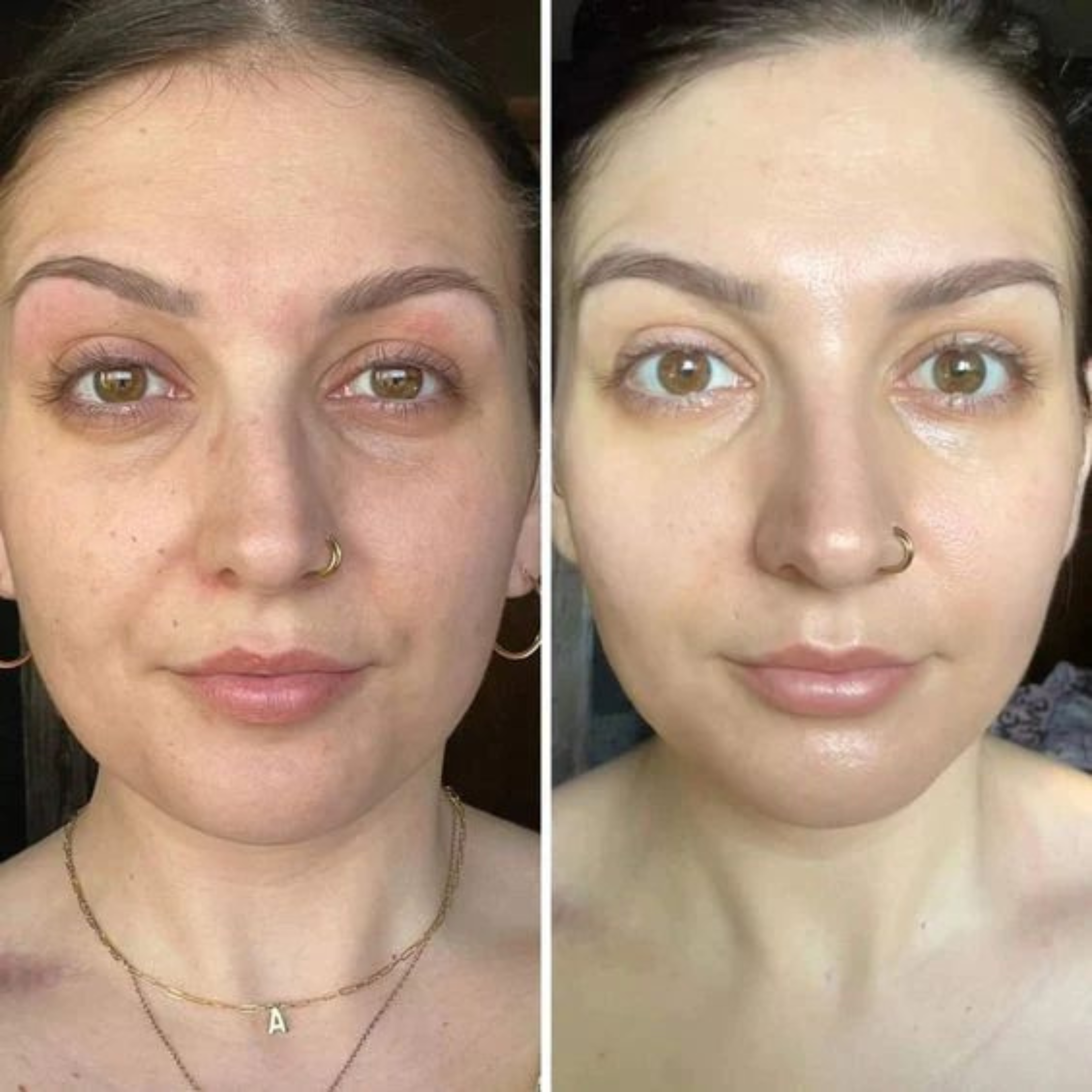 PDRN Pink Peptide Serum